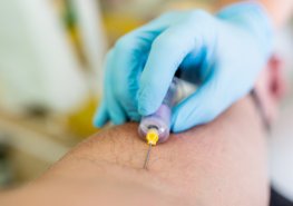 Laboratoř klinické biochemie nabízí vyšetření na protilátky covid-19