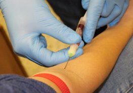 HIV poradna v Orlickoústecké nemocnici testuje bez předsudků