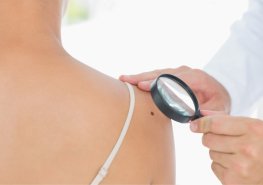 O Dny melanomu byl velký zájem. Kožní oddělení vyšetřilo za dva dny 672 lidí