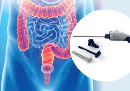 Lepší endoskop pro Orlickoústeckou nemocnici pomůže pořídit Nadační fond S námi je tu lépe!