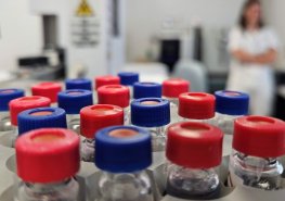 Pardubická toxikologie zařadila do svých screeningových vyšetření i test na kratom