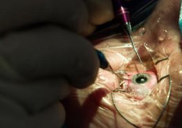 Pardubičtí oční lékaři získali ocenění na mezinárodním kongresu