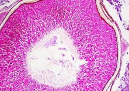 Bude se konat 2. krajský klinicko-patologický seminář „Patologie napříč obory“