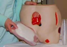 Stop dekubitům! Nemocnice radila, jak bojovat s proleženinami