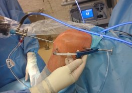 Prestižní mezinárodní kongres v Litomyšli představí nové trendy v artroskopii