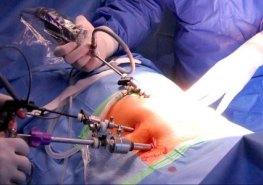 Setkání odborníků chce zlepšit multioborovou spolupráci v chirurgii pánevního dna