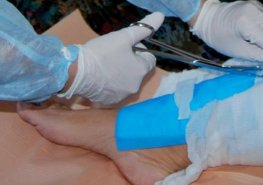 Pardubická nemocnice pomáhá s léčbou nemocných v domácím prostředí