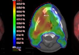 Nemocnice Pardubického kraje může v brzké budoucnosti pořídit přístroj na PET/CT vyšetření