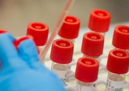 Nemocnice Pardubického kraje veřejnost na COVID-19 netestuje