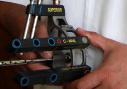 Světový odborný tisk objevuje unikátní patní hřeb pardubického traumatologa