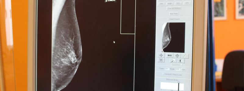 Poznejte svá prsa a nepodceňujte prevenci. Růžový říjen připomíná boj proti rakovině prsu