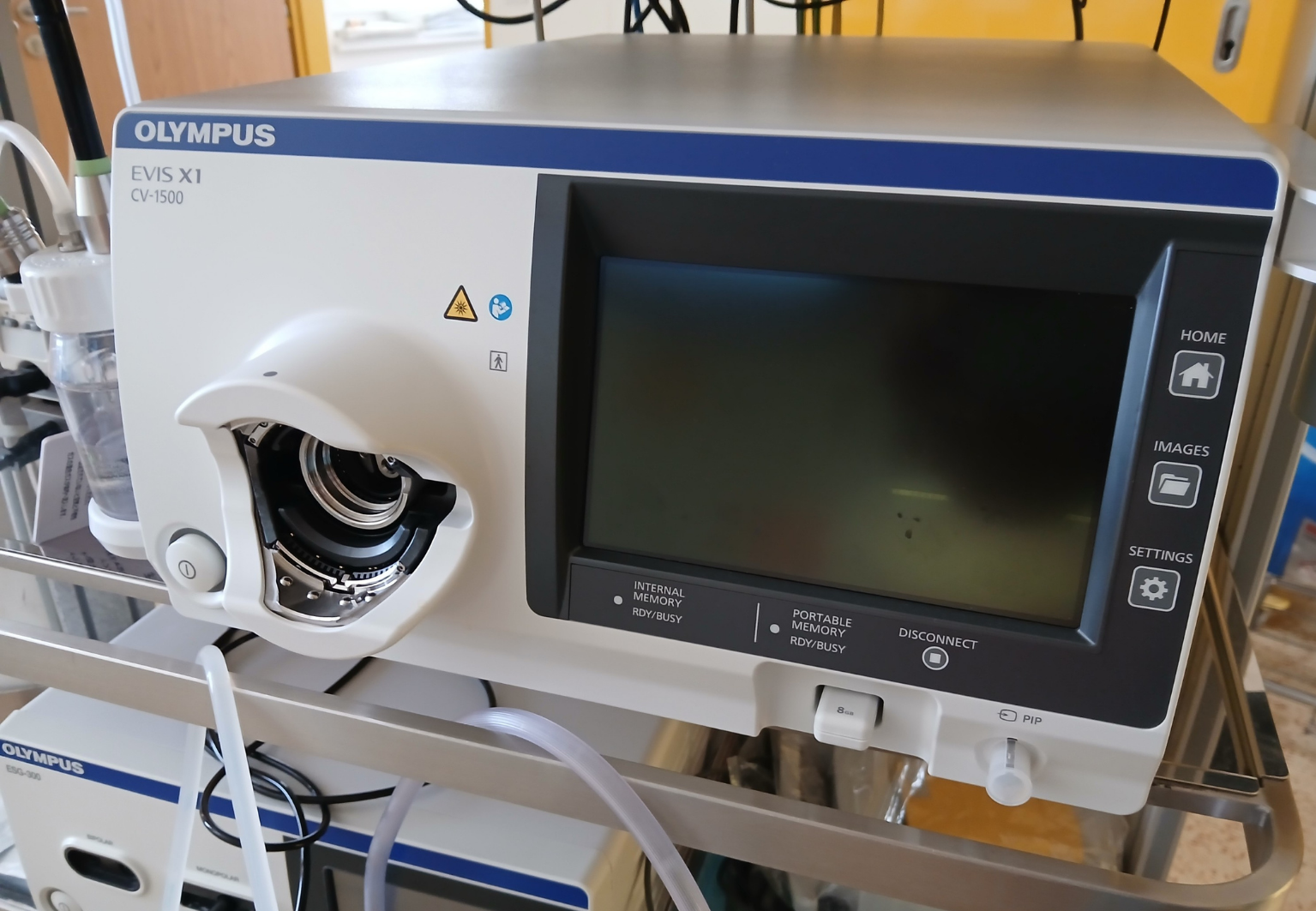 NPK pokračuje v modernizaci screeningových pracovišť. Posílila prevenci kolorektálního karcinomu