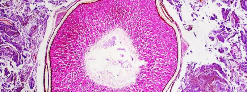 Bude se konat 2. krajský klinicko-patologický seminář „Patologie napříč obory“