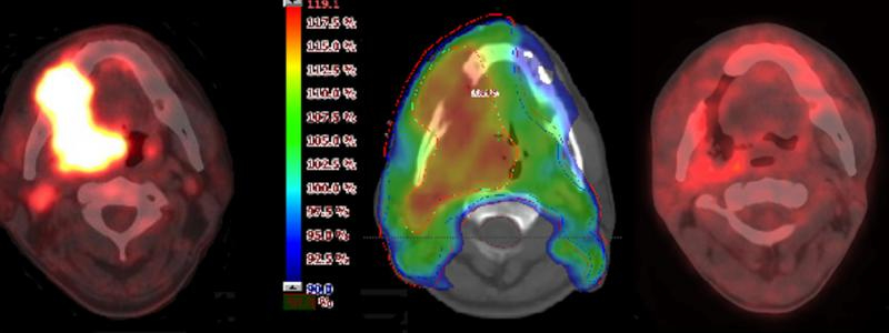 Nemocnice Pardubického kraje může v brzké budoucnosti pořídit přístroj na PET/CT vyšetření